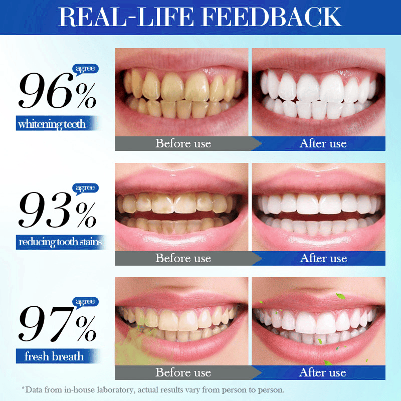 💥Hot Listing 🔥Alisanda™ Hydroxyapatite Toothpaste 7.5% for Enamel Repair & Teeth Whitening Refreshing Flavor Fluorid