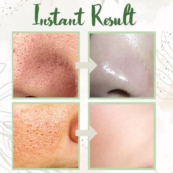 Final Sale - Green Tea Deep Cleanse Mask (🔥LAST DAY SALE-80% OFF)