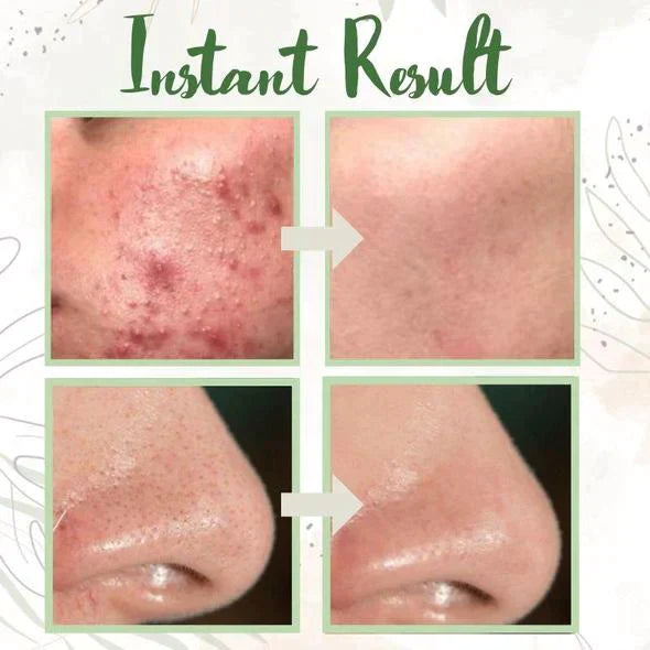 Final Sale - Green Tea Deep Cleanse Mask (🔥LAST DAY SALE-80% OFF)