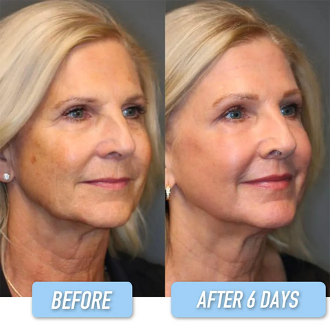 🎉🎉LOVILDS™ Collagen Firming Cream – Firm & Brighten, 60% OFF Limited Time!