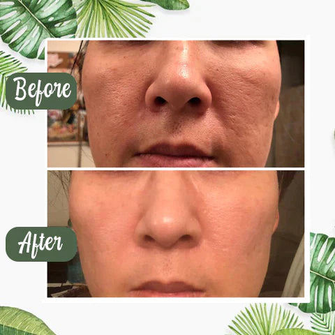 Final Sale - Green Tea Deep Cleanse Mask (🔥LAST DAY SALE-80% OFF)