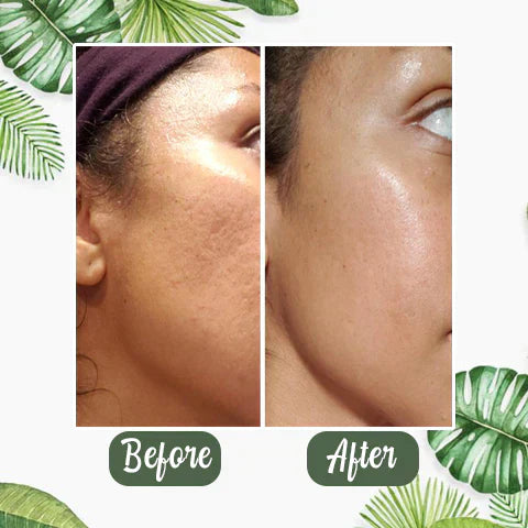 Final Sale - Green Tea Deep Cleanse Mask (🔥LAST DAY SALE-80% OFF)