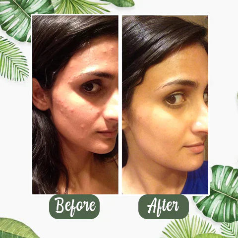 Final Sale - Green Tea Deep Cleanse Mask (🔥LAST DAY SALE-80% OFF)