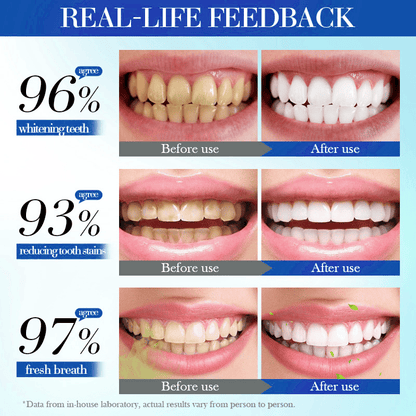 💥Hot Listing 🔥Alisanda™ Hydroxyapatite Toothpaste 7.5% for Enamel Repair & Teeth Whitening Refreshing Flavor Fluorid